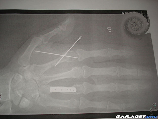 https://www1.garaget.org/gallery/archive/10774/473385_s1dgtz.jpg